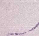 Blood-smear-WS-OI