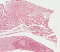 Larynx-longitudinalX